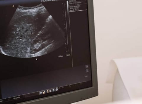 kako izgleda ultrazvuk abdomena