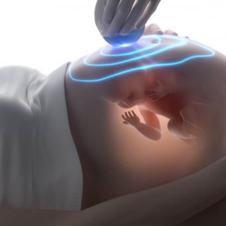 Anomaly scan ultrazvuk