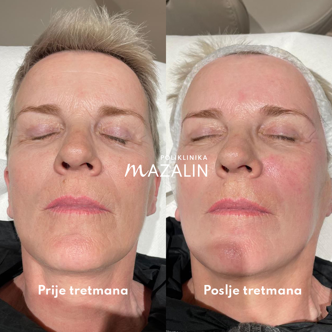 Med Contour