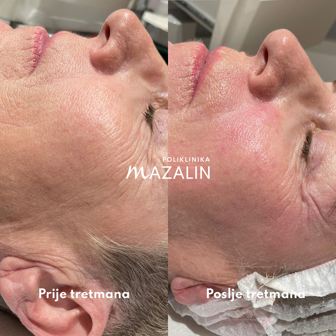 Med Contour