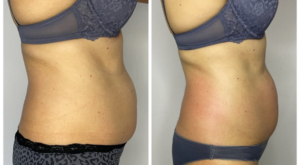 Med Contour