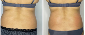 Med Contour