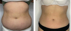 Med Contour