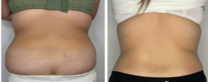 Med Contour