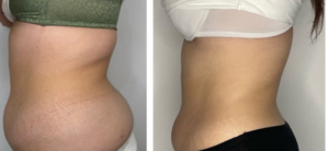 Med Contour