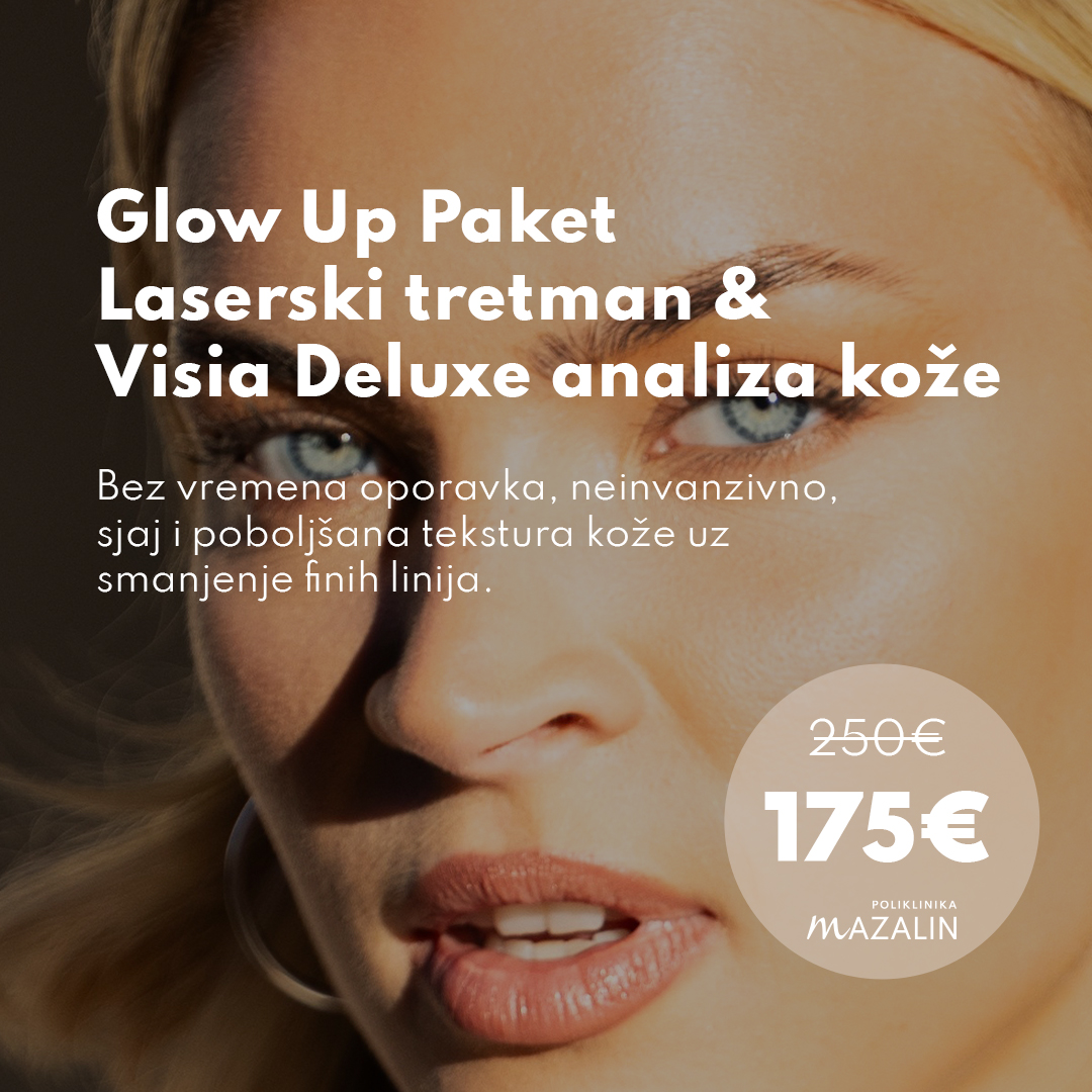 Rujanska promocija - Glow up